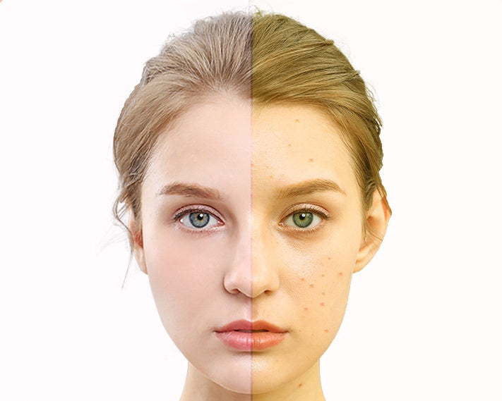 HoneyGlow LED Light Therapy Face Mask
